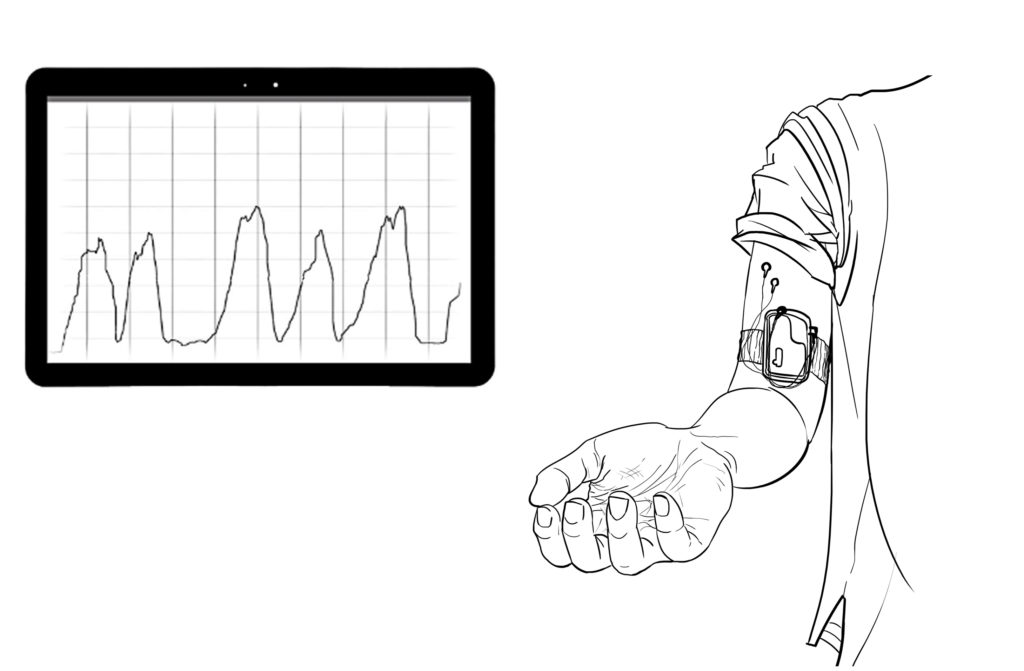A drawing of a patient wearing a digital monitoring device with a monitor illustrates the role of Digital Therapeutics in Treating Mental Health.